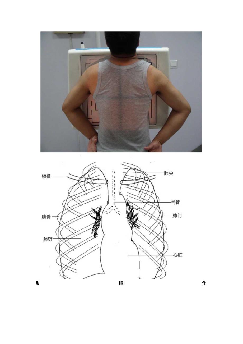 医院影像科放射摄影体位标准操作规范（50种体位图文详解）.docx_第2页