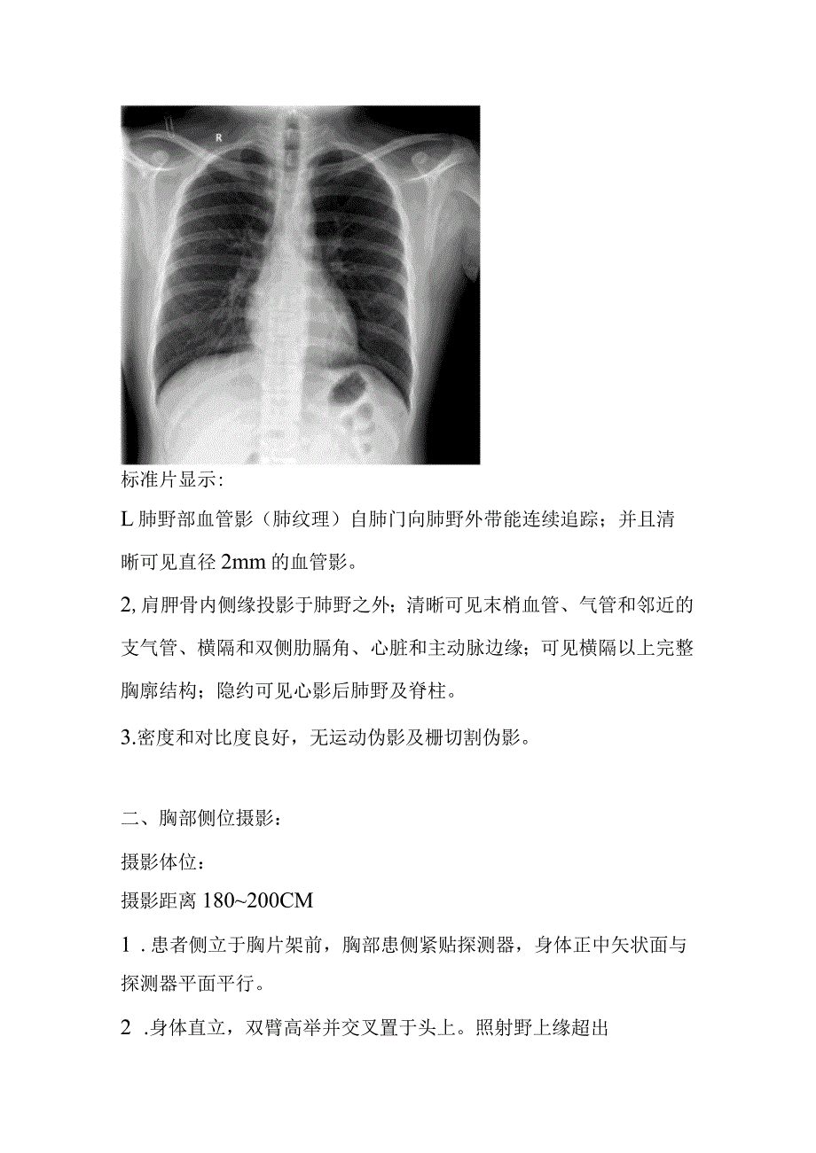 医院影像科放射摄影体位标准操作规范（50种体位图文详解）.docx_第3页