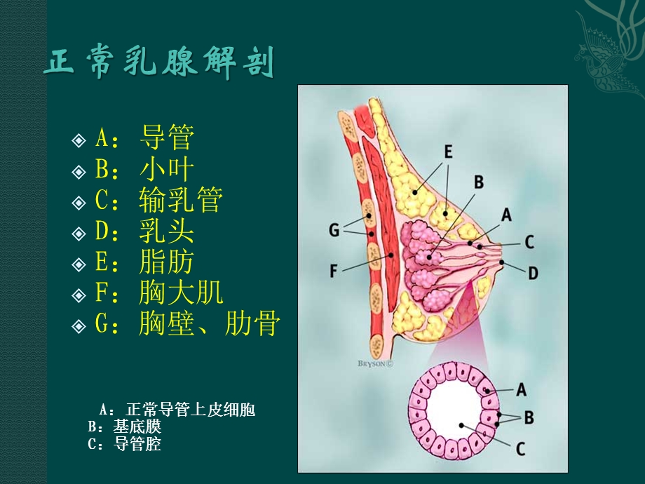 乳腺的超声诊断.ppt_第3页