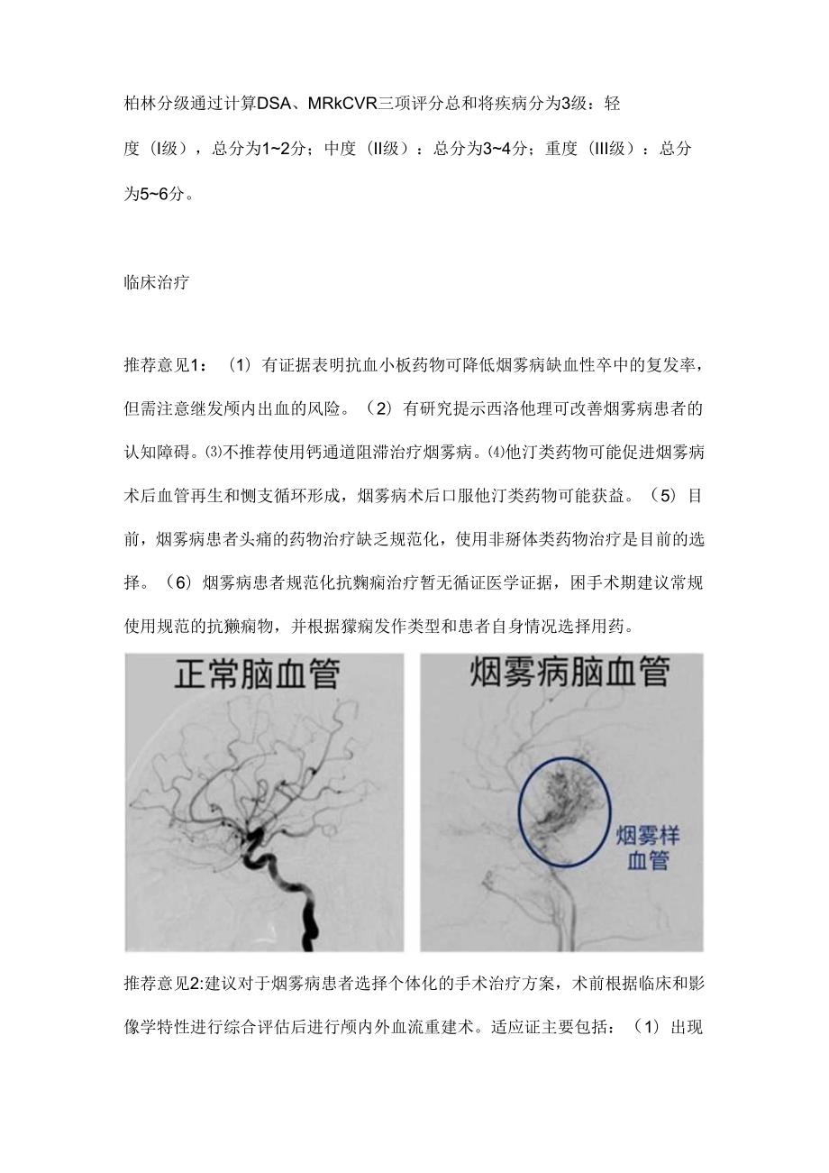 2024烟雾病和烟雾综合征诊断与治疗专家共识(附表).docx_第3页