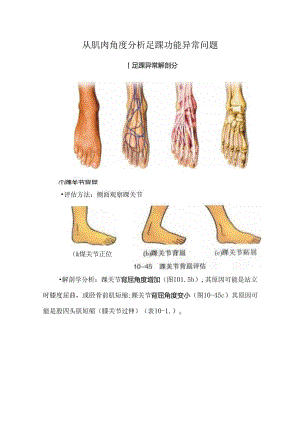 从肌肉角度分析足踝功能异常问题.docx