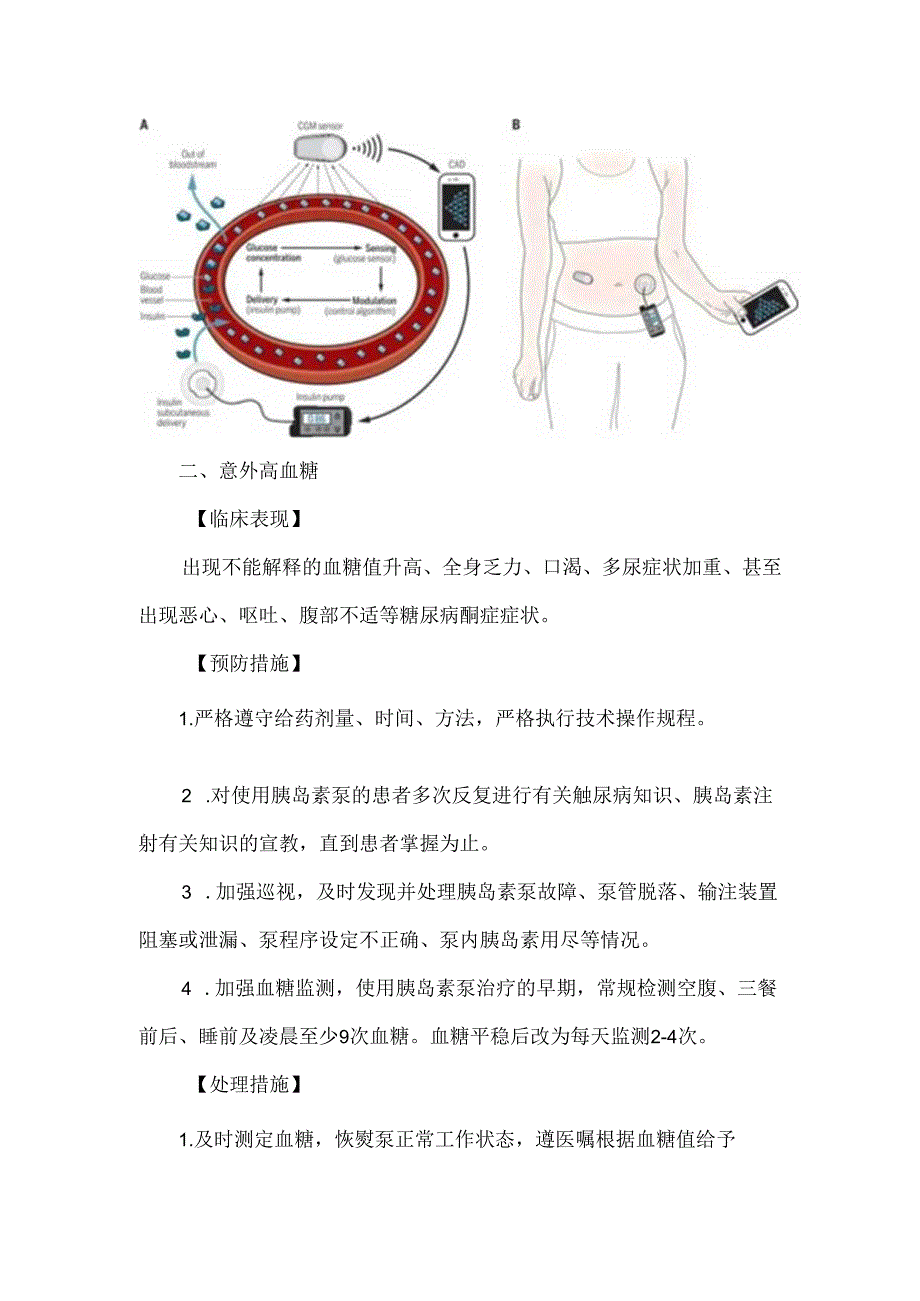 胰岛素泵使用技术操作并发症的预防及处理.docx_第2页