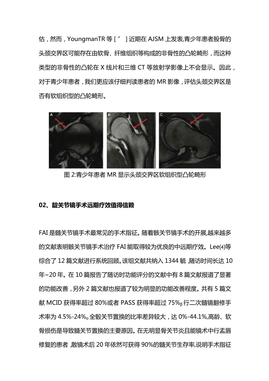 2023髋关节镜手术新进展.docx_第3页