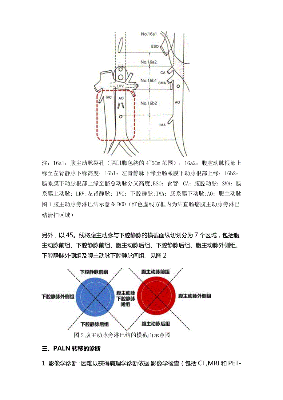 2024结直肠癌腹主动脉旁淋巴结清扫研究进展.docx_第3页