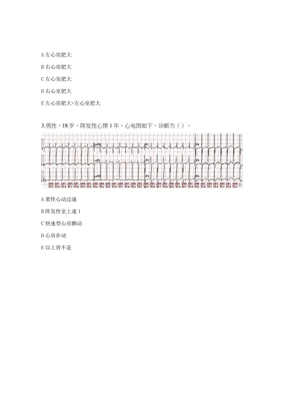 医院心电图理论考核试题.docx_第2页