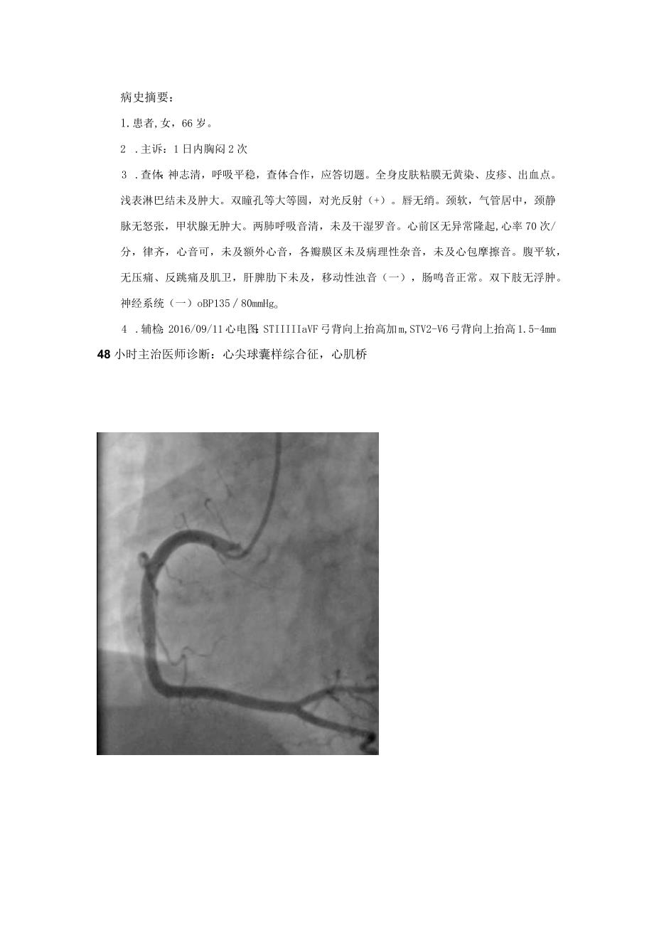 第二例心尖球样综合征.docx_第1页