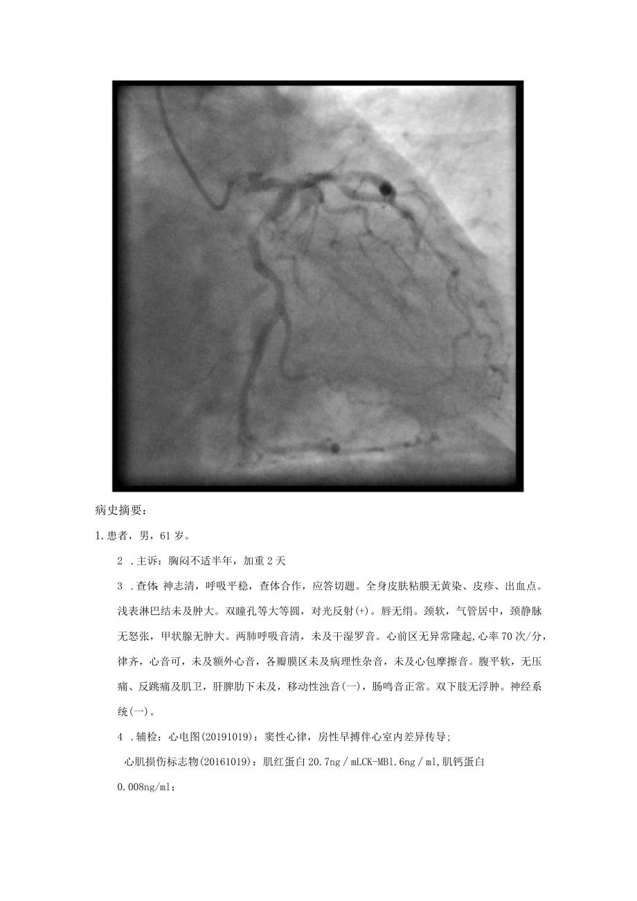 LM斑块破裂.docx_第1页