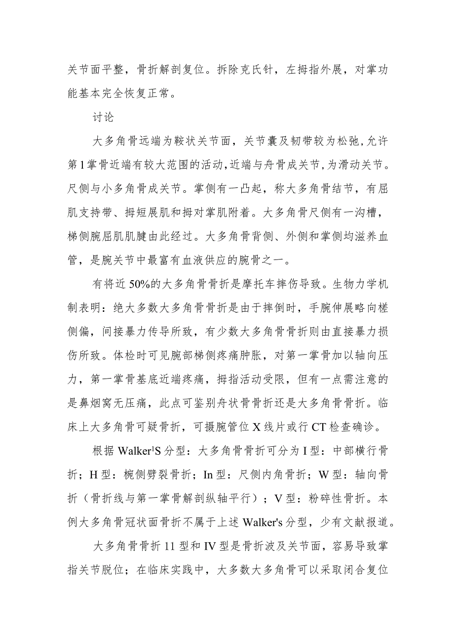 骨科罕见孤立单纯大多角骨冠状面骨折病例分析专题报告.docx_第2页