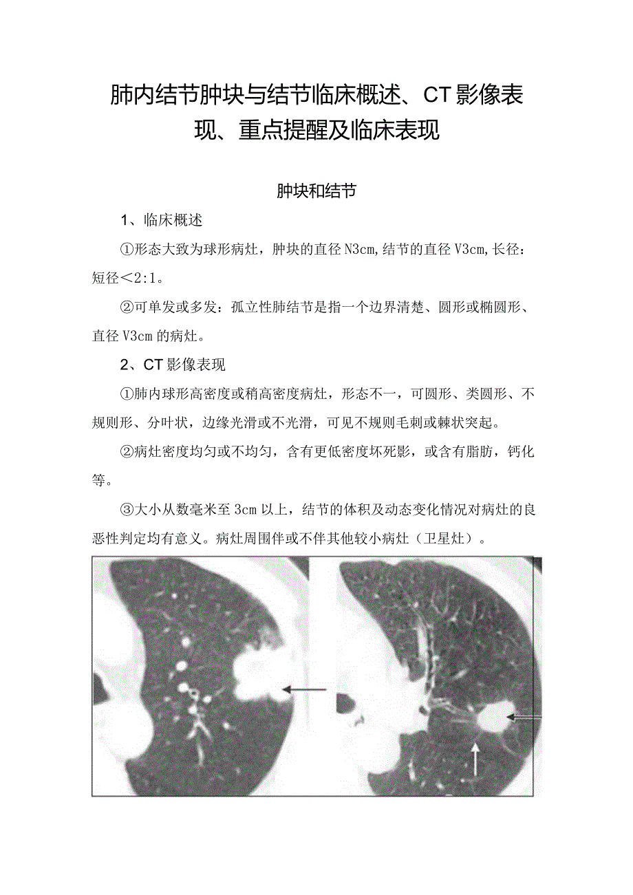 肺内结节肿块与结节临床概述、CT影像表现、重点提醒及临床表现.docx_第1页