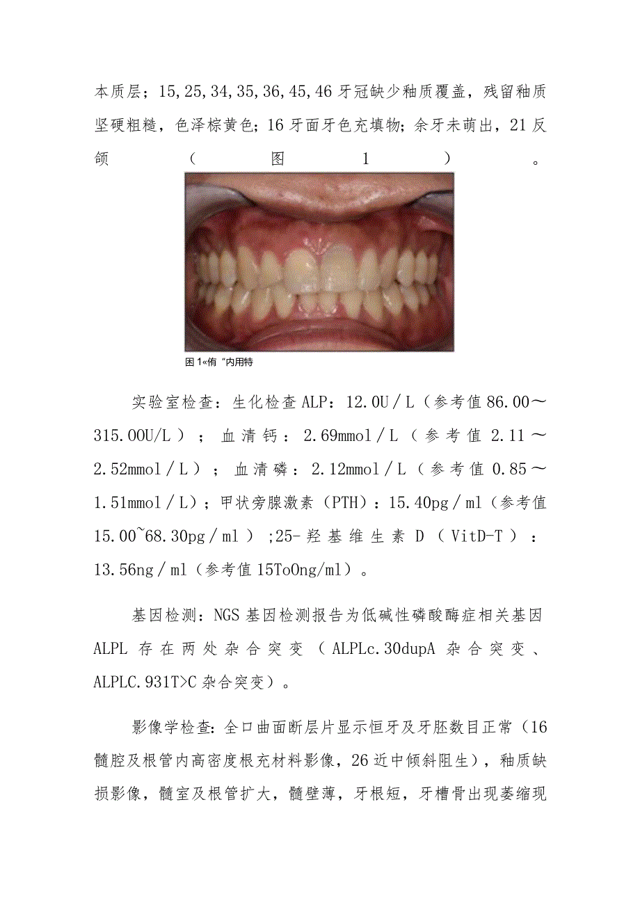 口腔科牙型低磷酸酯酶症病例分析专题报告.docx_第2页