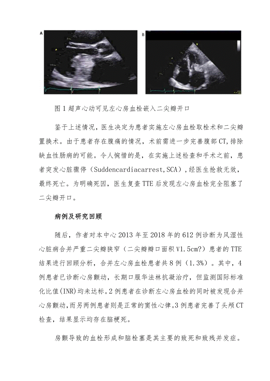 神经内科猝死病例分析专题报告.docx_第2页