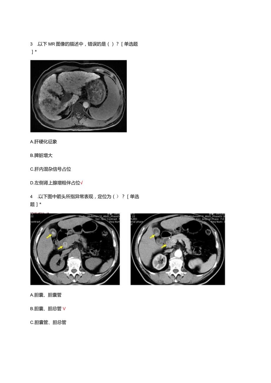 放射科-临床思维理论考核试题及答案.docx_第3页