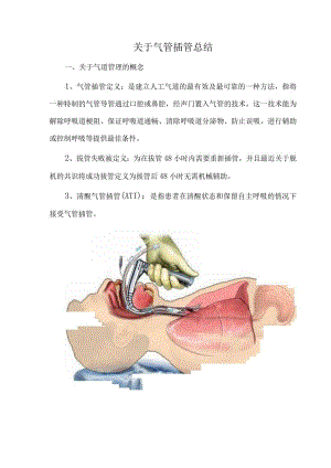 关于气管插管总结.docx