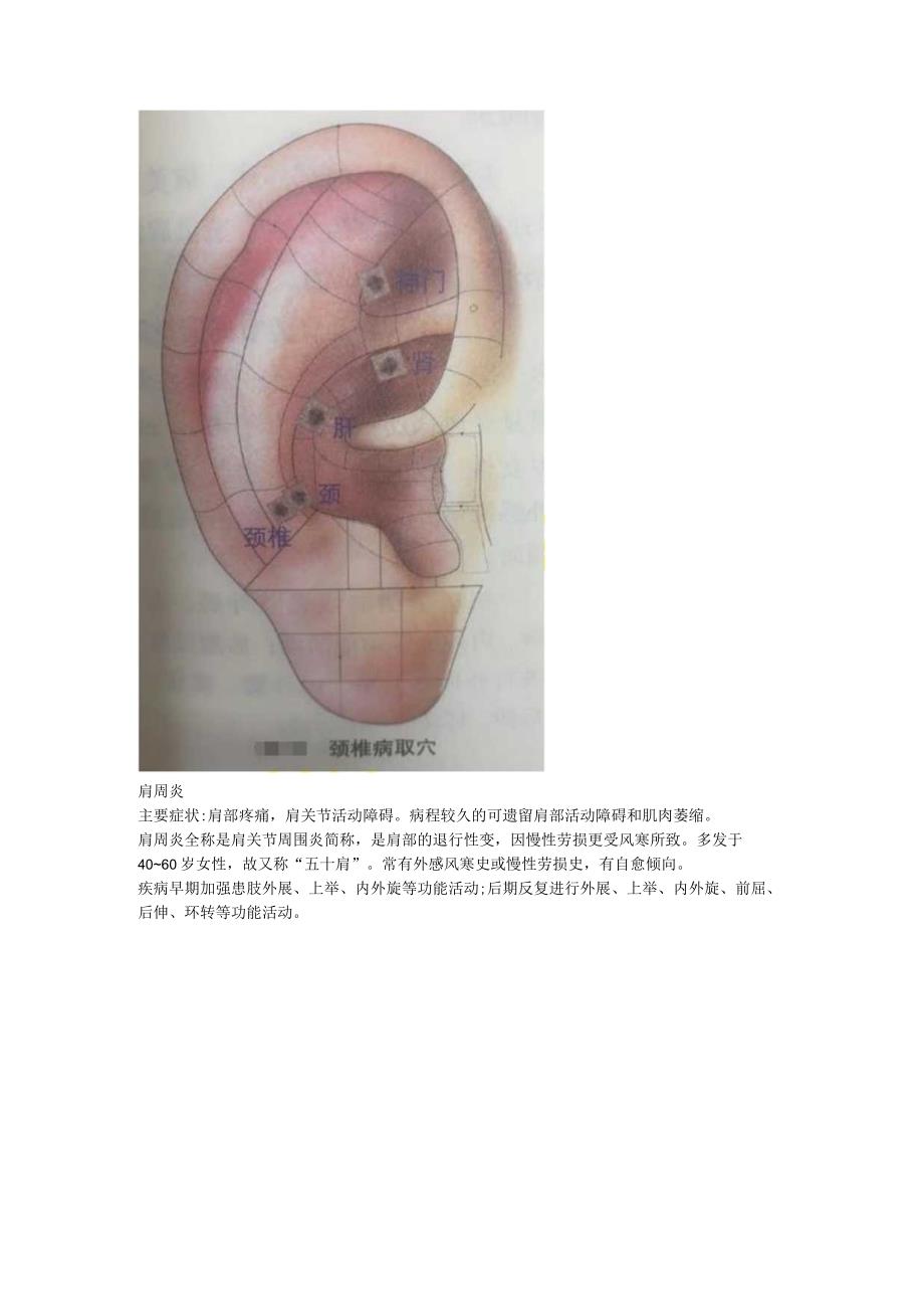 2.20耳穴 落枕 颈椎病 肩周炎 网球肘.docx_第2页