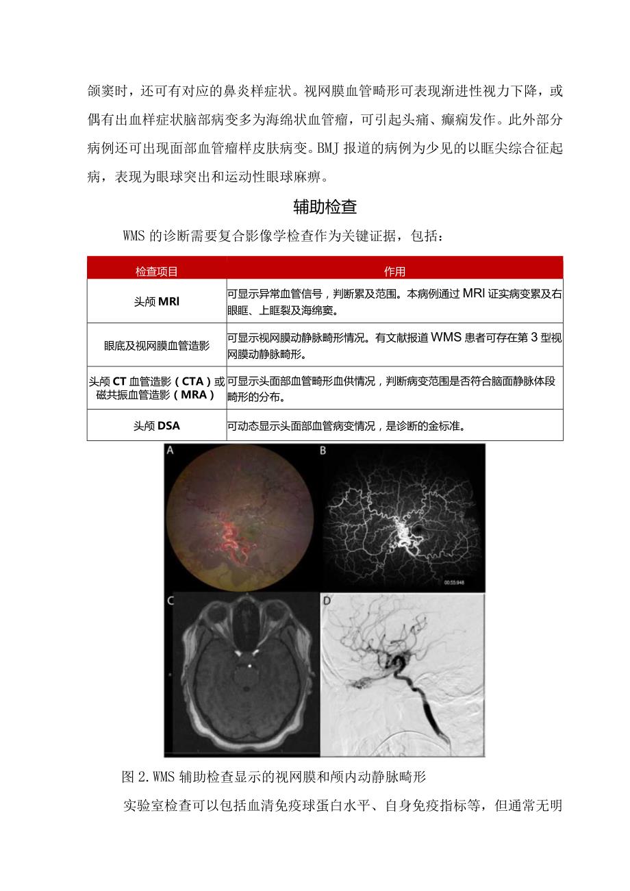 临床Wyburn-Mason综合征病理、临床表现、辅助检查、鉴别诊断及治疗预后.docx_第2页