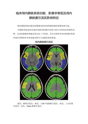 临床颅内静脉系统功能、影像学表现及颅内静脉窦引流区影响特征.docx