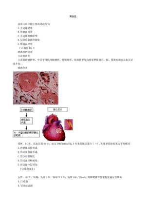 心血管内科主治医师资格笔试专业实践能力考点解析 (6)：高血压.docx