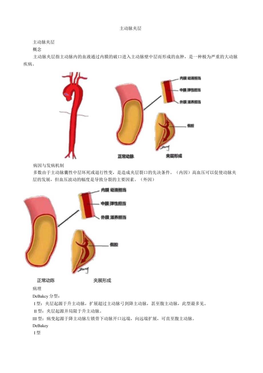 心血管内科主治医师资格笔试专业知识考点解析 (11)：主动脉夹层.docx_第1页