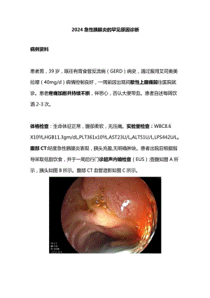 2024急性胰腺炎的罕见原因诊断.docx