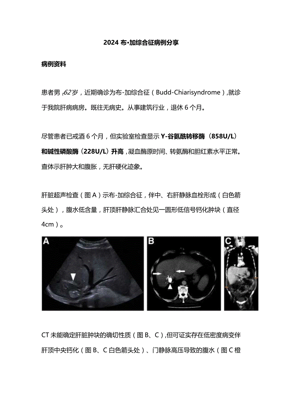 2024布-加综合征病例分享.docx_第1页