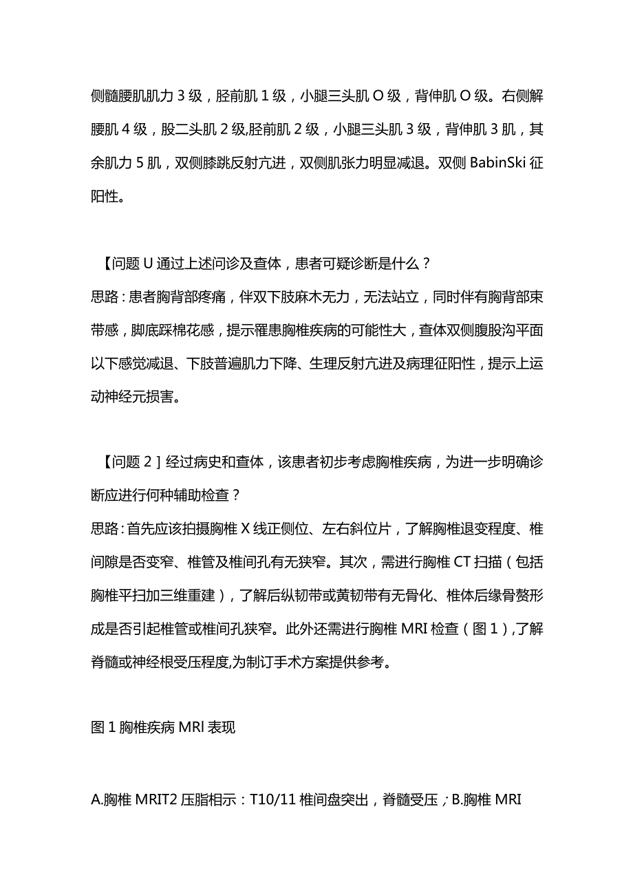 2024胸椎间盘突出症的诊疗策略.docx_第2页