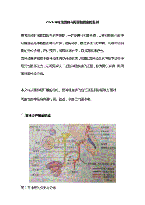 2024中枢性面瘫与周围性面瘫的鉴别.docx