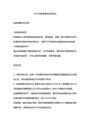 2024动脉留置针监测血压.docx