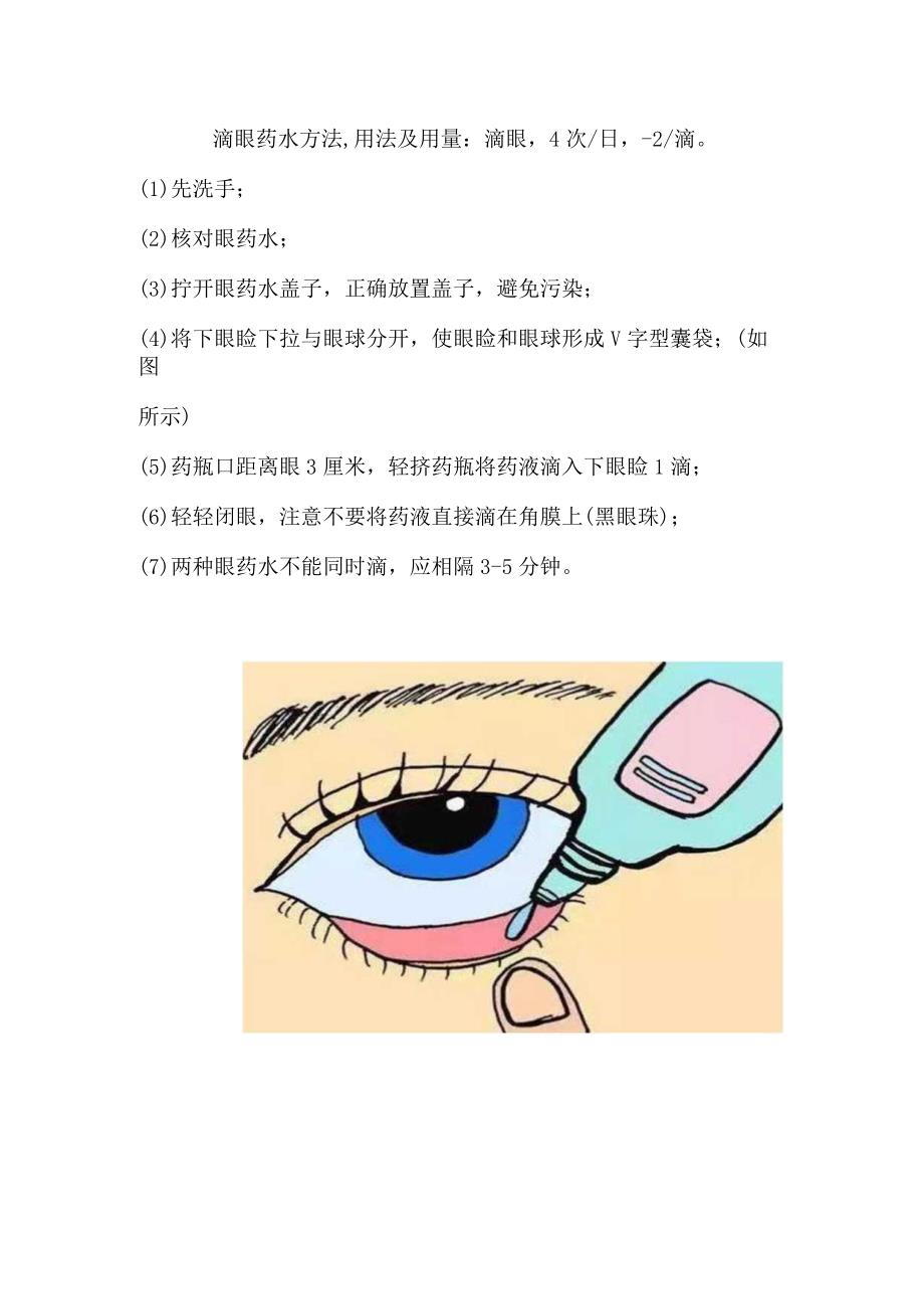 滴眼药水方法.docx_第1页