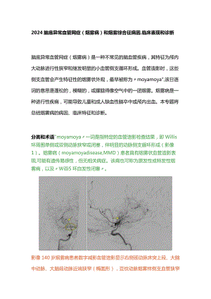 2024脑底异常血管网症(烟雾病)和烟雾综合征病因、临床表现和诊断.docx