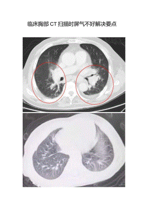 临床胸部CT扫描时屏气不好解决要点.docx