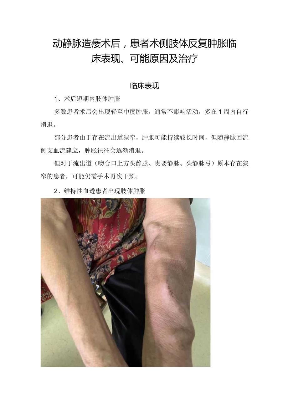 动静脉造瘘术后患者术侧肢体反复肿胀临床表现及可能原因.docx_第1页