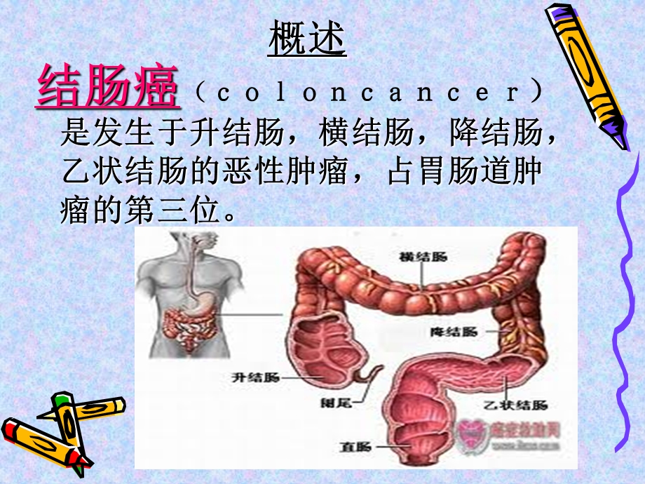 右半结肠切除术护理查房精要.ppt_第3页