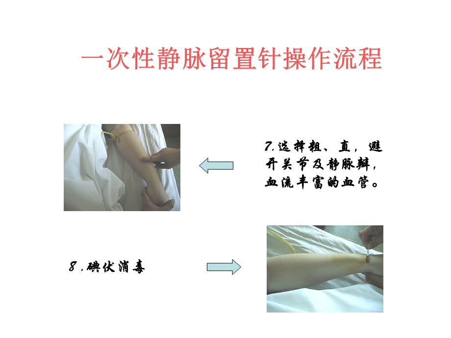 一次性静脉留置针操作流程.ppt_第3页