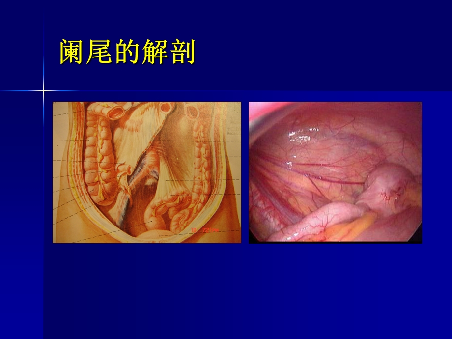 培训资料急性阑尾炎教学查房1.ppt_第2页