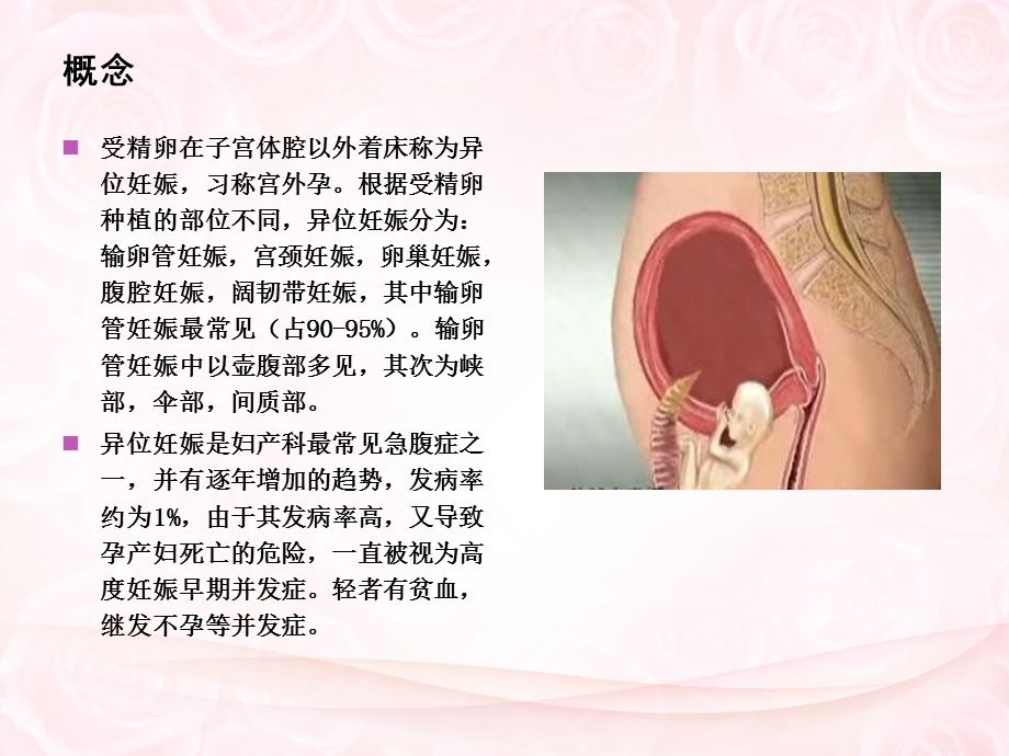 培训资料异位妊娠的中医辩证.ppt_第3页