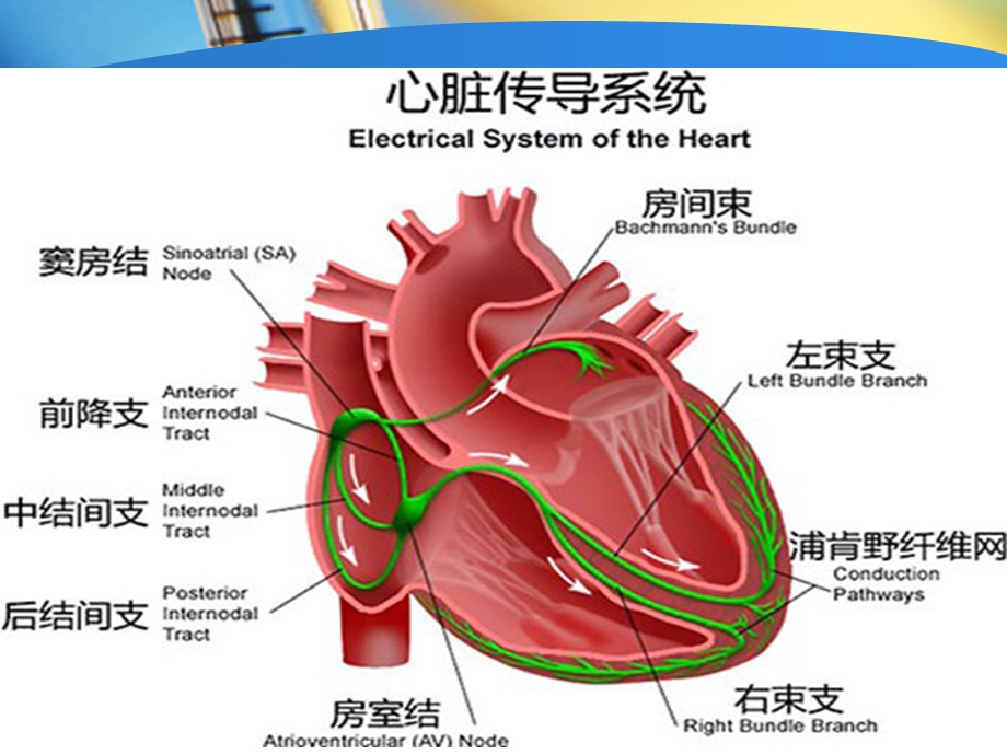 心脏起搏器原理及手术护理.ppt_第2页