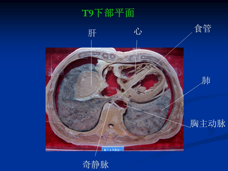 断层解剖 高清图.ppt_第2页