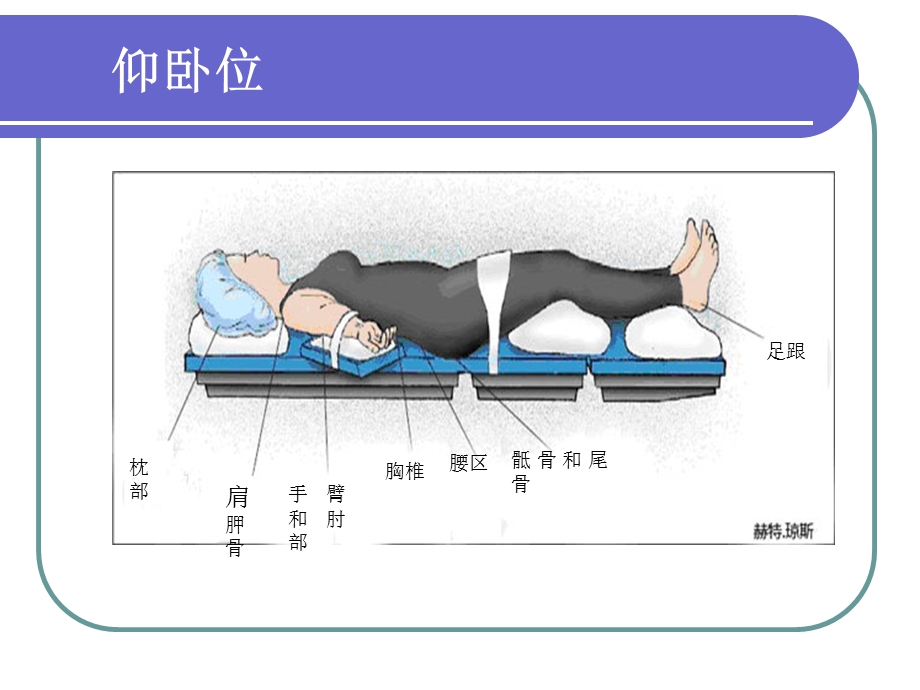 手术体位与压疮因素.ppt_第3页