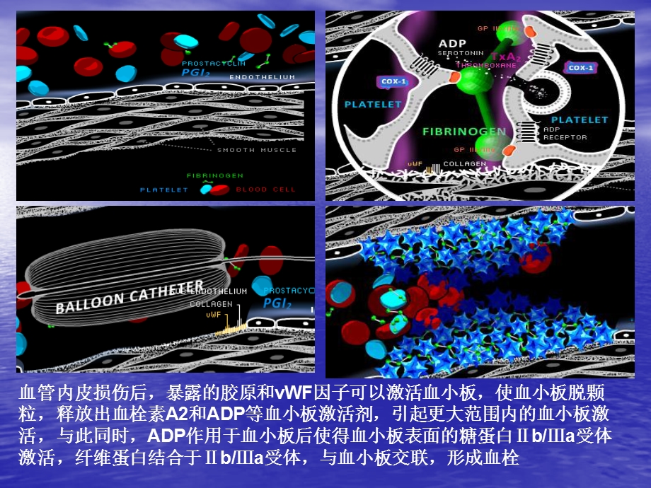 抗血小板治疗.ppt_第2页