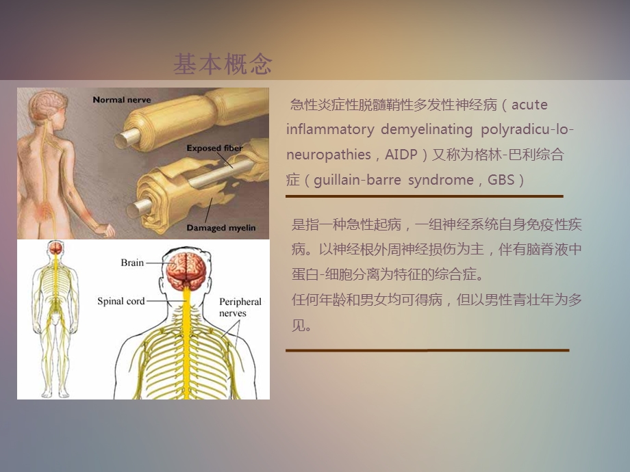 格林巴利综合症的护理查房.ppt_第3页