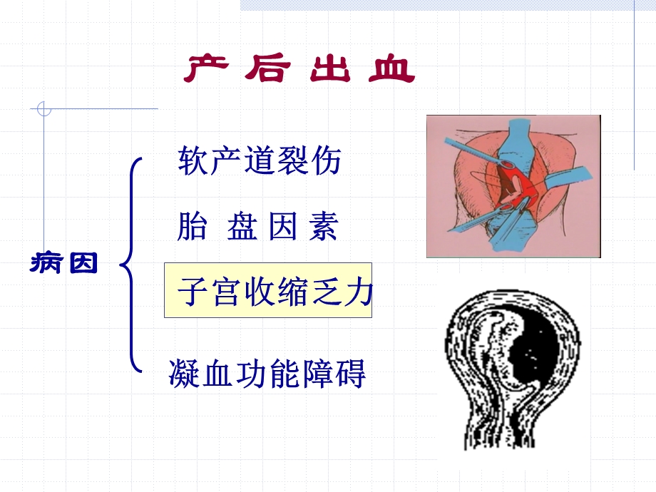 母婴护理.ppt_第3页