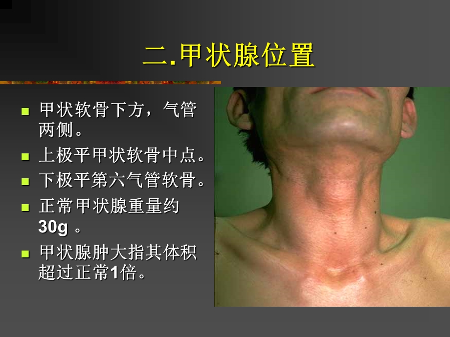 甲状腺病.ppt.ppt_第3页