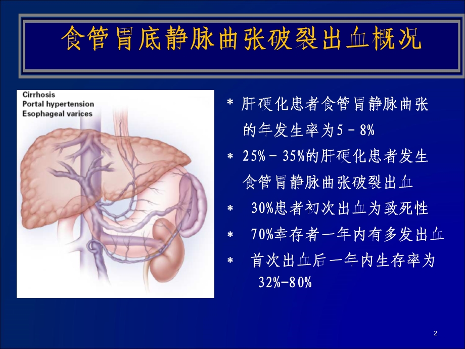 浅析食管胃底静脉曲张破裂出血的各种预防措施.ppt_第2页