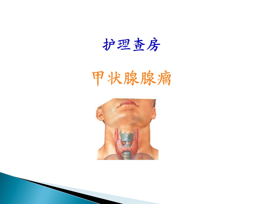 甲状腺腺瘤护理查房.ppt_第1页