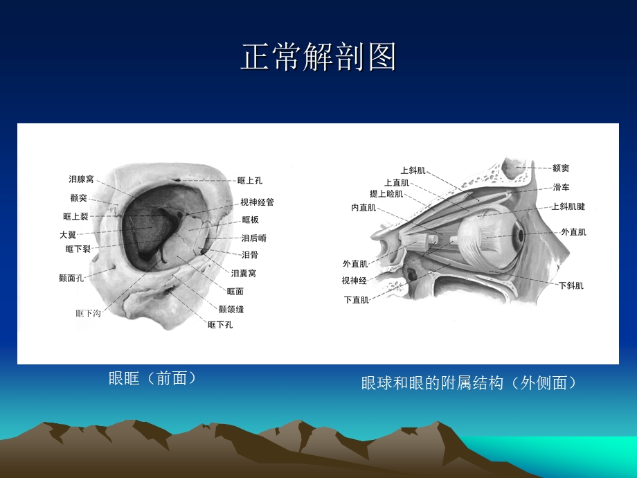 眼和眼眶的影像学诊断.ppt_第3页