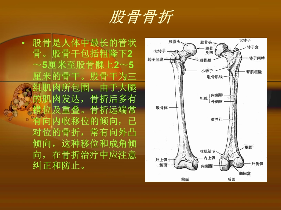 股骨干骨折护理查房.ppt_第3页