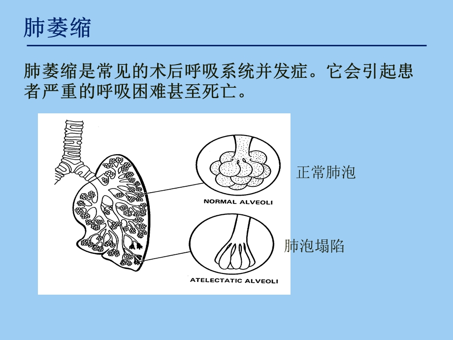 肺萎缩与深呼吸训练器.ppt_第2页