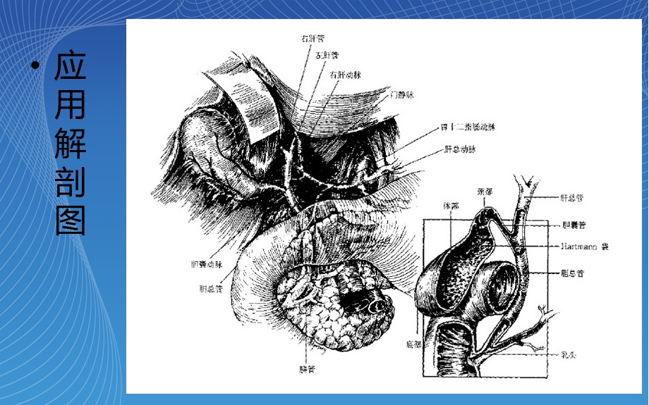 胆石症切除术护理查房.ppt_第3页