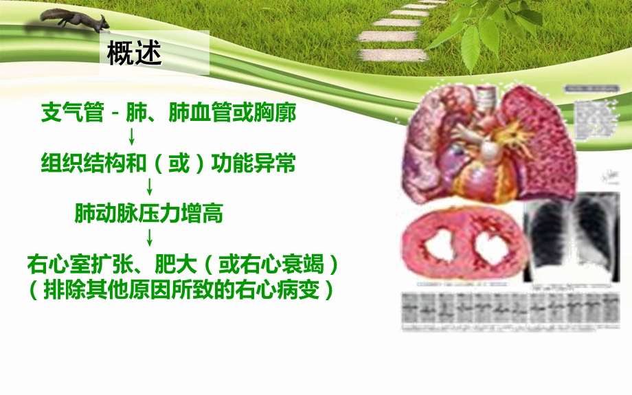 肺源性心脏病病人的护理.ppt_第2页