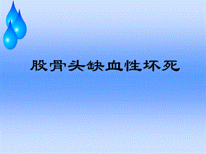 股骨头缺血性坏死护理查房.ppt